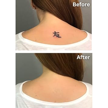 Dermaflage Tattoo Cover Up Makeup (Bronze) - Bruise Full Coverage Concealer - Full Coverage Waterproof Concealer for Bruise, Scar & Acne - Smudge Proof Body Makeup Palette with 3 Pro SFX Shades +Brush