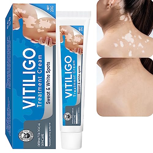 Vitiligo Cream Natural Vitiligo Treatment for Skin Vitiligo Easy to Use Vitiligo Care Cream Reduce White Spots and Improve Skin Pigmentation 20g