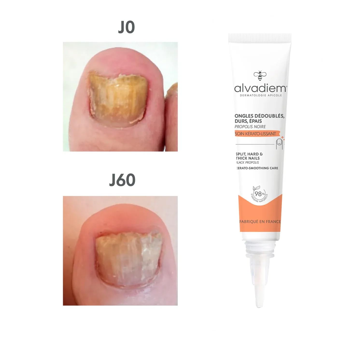 Alvadiem | Soin Ongles Kérato-Lissant à la propolis noire | Ongles durs, épais, psoriasis | Affine & restructure les ongles durs & épais | Lutte contre l’oxydation | Fabriqué en France | 10ml