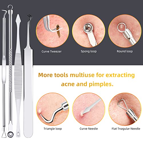 AIBEE Mitesserentferner Komedonenquetscher Set -10PCS Blackhead Remover mit Akne Pickel Pinzette Mitesser Entferner,Pickel Ausdrücken Werkzeug mit Metallgehäuse (Edelstahl)