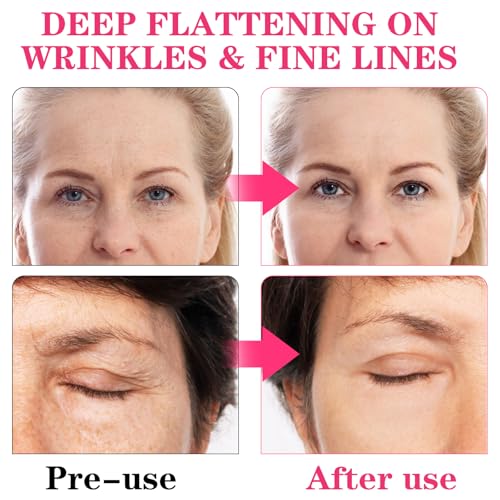 AOZUO 2 rolos de fita para lifting facial, adesivos antirrugas para mulheres e homens, adesivos para