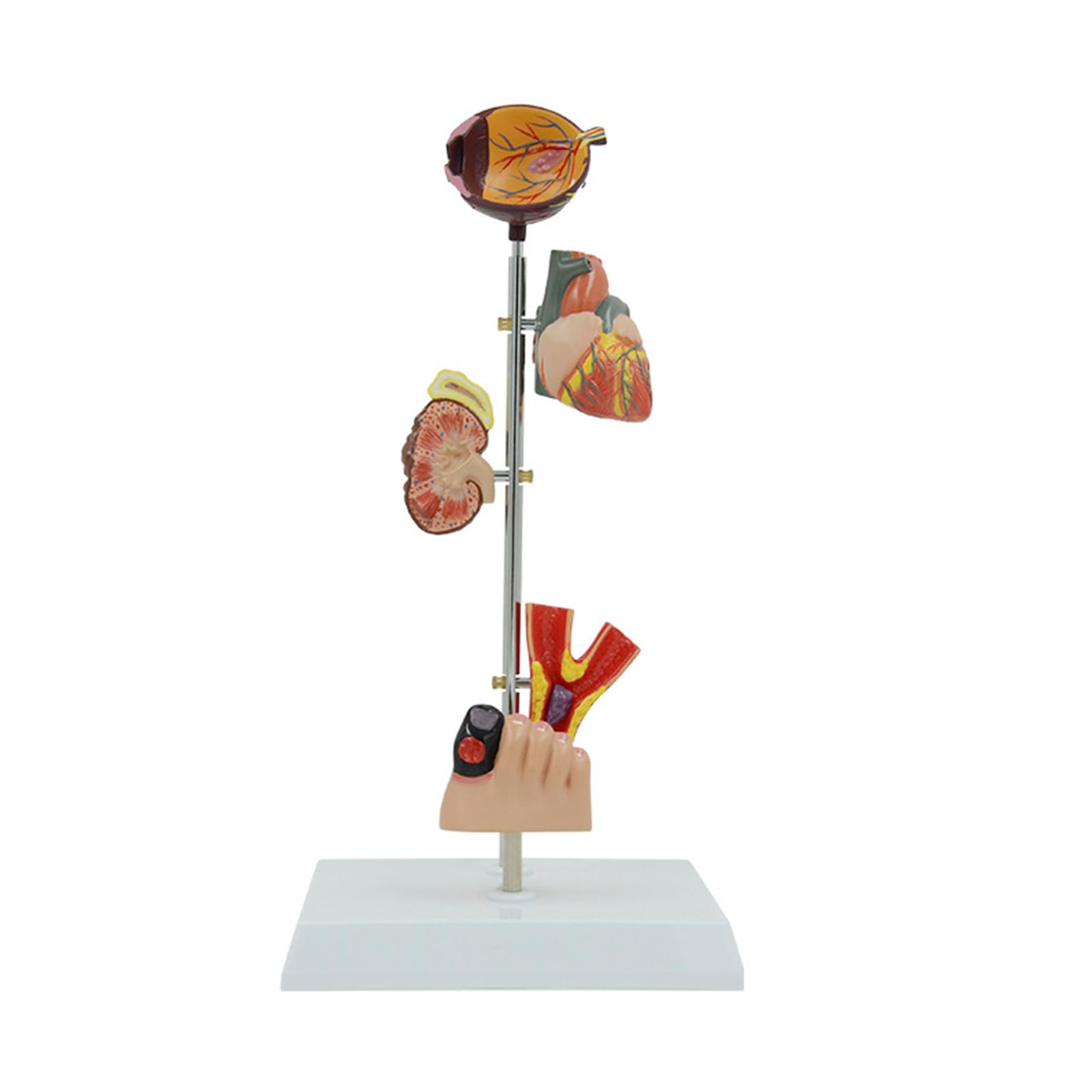 RBRMHM Pathological Anatomy Model for Diseases Study, Human Pathology Demonstration Model Medical Teaching