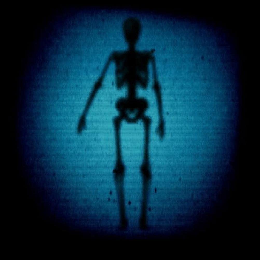 Esqueleto de Halloween, Cuerpo de Esqueleto de Halloween Que Brilla en la Oscuridad Cuerpo de Esqueleto de Halloween Aterrador para la Mejor decoración de Halloween Little Surprise