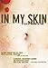 In My Skin