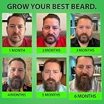 Best Beard Stuff Growth Kit with 5% Minoxidil Serum (Minoxidil 5 Percent + 2X BIOTIN + Rice Water) & Beard Roller for Men - Image 4