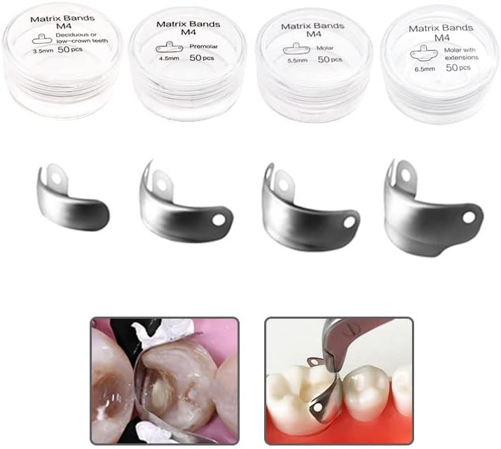 Miniatura 5 de Sistema de matriz seccional dental, juego de anillos y bandas de matriz dental, anillo de bandas de matriz seccional dental, anillo de abrazadera de