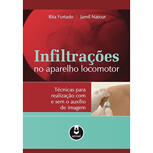 Infiltrações do Aparelho Locomotor: Técnicas para Realização com e sem o Auxílio de Imagem