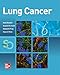 Lung Cancer: Standards of Care