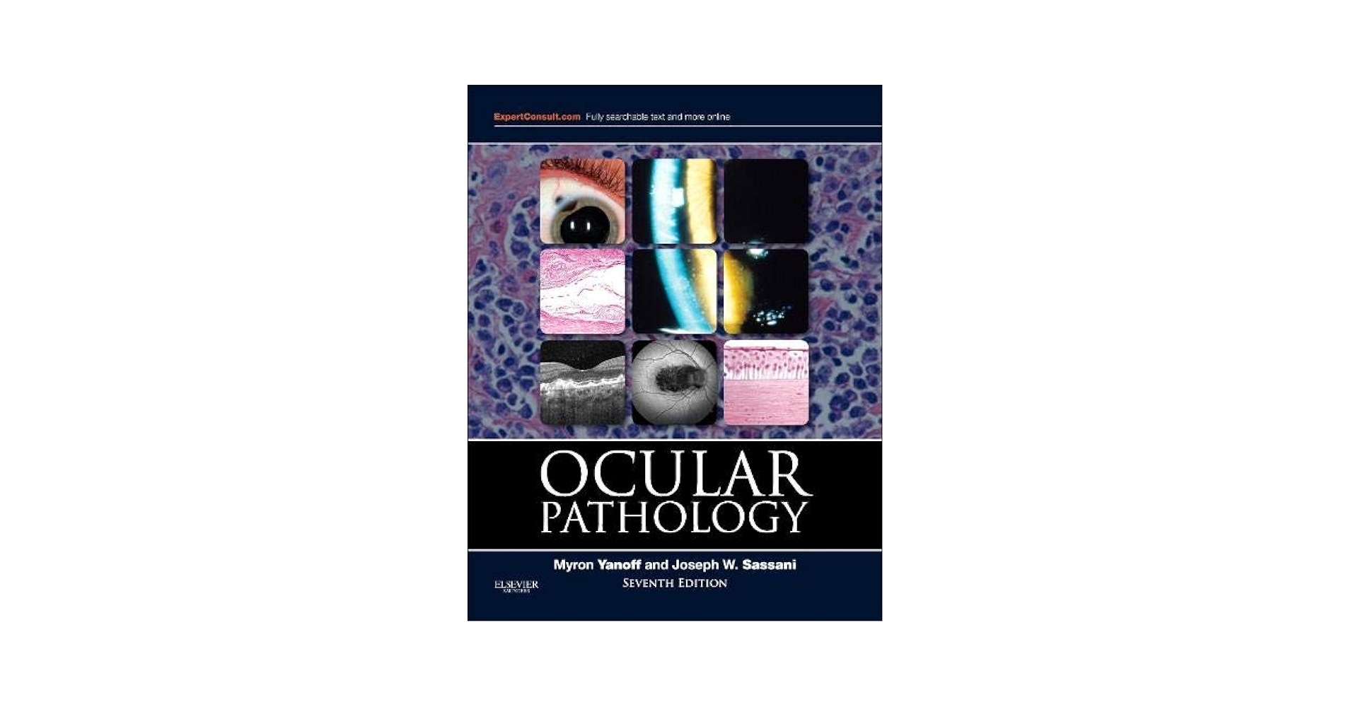 Ocular Pathology: 9781455728749: Medicine & Health Science