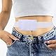Heallily 2 stücke peritonealdialysekatheter gürtel nelmed g-rohr holde magensonde gürtel peritonealdialyse gastrostomie peg für patienten krankenhaus zu hause