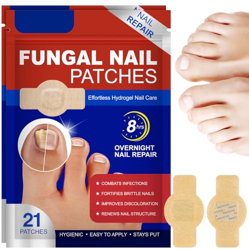 42pcs Fungal Nail Patches, Pansements Antimycosiques pour Ongles, Renforcement des Ongles, Réparer Abîmés Patches Antifongiques Ongle Pieds (beige 42pcs)