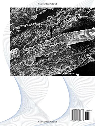 The Cordocytes of the Human Brain. An Atlas of Light and Electron Microscopy