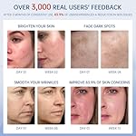 2-in-1 Face Serum, Vitamin C and Retinol Face Serum, Anti-Aging Skincare Set with Hyaluronic Acid, Niacinamide and Retinol for Anti-Wrinkle and Firming - Image 4