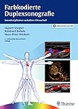 Farbkodierte Duplexsonografie: Interdisziplinärer vaskulärer Ultraschall