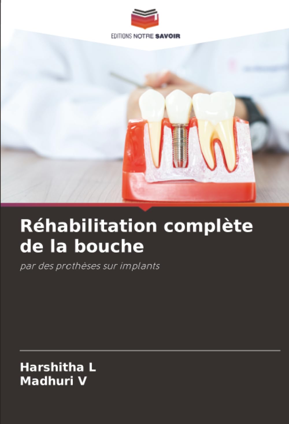 Réhabilitation complète de la bouche: par des prothèses sur implants
