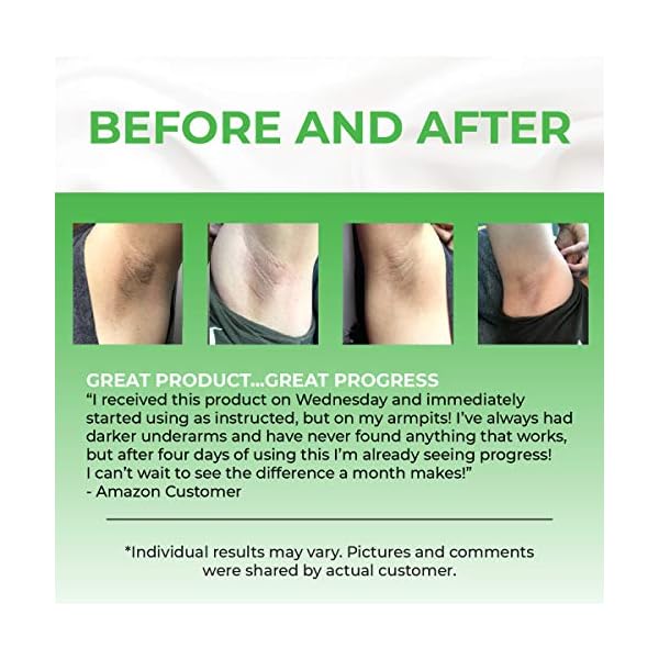 Skin-Lightening-Cream-Dark-Spot-Corrector-Brightening-Serum-For-Face-Underarm-Inner-Thighs-Bikini-Areas-With-Kojic-Acid-and-Jojoba-Oil-by-Pureauty-Naturals Skin Lightening Cream Dark Spot Corrector - Brightening Serum For Face, Underarm, Inner Thighs, Bikini Areas With Kojic…