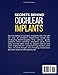 SECRETS BEHIND COCHLEAR IMPLANTS