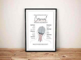 Cervical Misalignment Poster, Body Imbalance Print, Spinal Nerve Chart, Chiropractic Doctor Decor Office Room, Nervous System Wall Art, Cervical Spine Canvas, The Effects Of A Cervical Misalignment