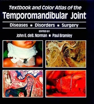 Hardcover Textbook and Color Atlas of Temporomandibular Joint: Diseases, Disorders, Surgery Book