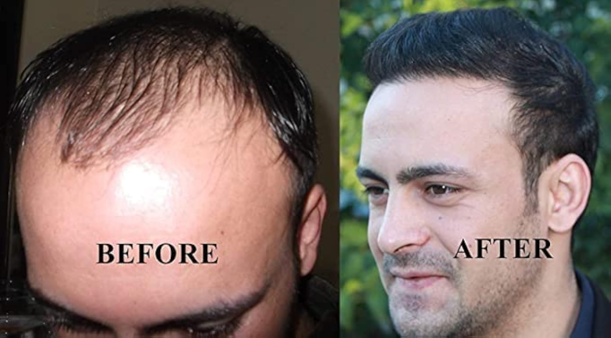 Men's Monofilament Hair Patch Toupee, Natural Hair System