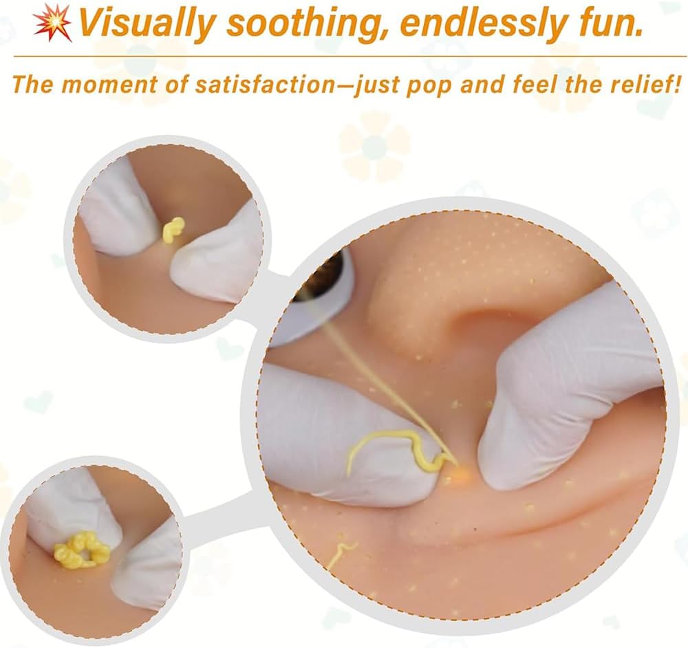 Refillable Pimple Popper Toy - Big Head Squeeze Toy with Black Hair & Refillable Pus Gel, Gross Yet Satisfying Stress Relief for Adults, Funny Gag Gift