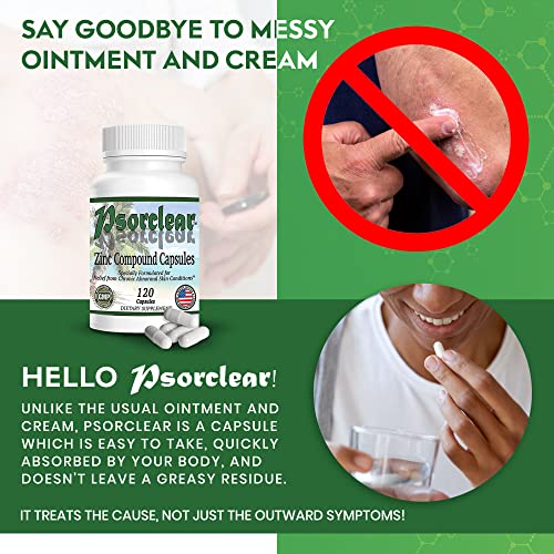 Psorclear-Psoriasis & Eczema Relief | A Proven Effective and All-Natural Product for Psoriasis Eczema & Rosacea Relief That Works - Rated One of The Best (120 Count Bottle) - Image 4