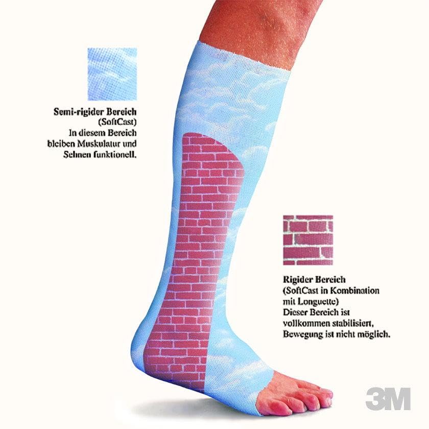 Soft Cast 82101B Verbände, 2,5 cm x 1,8 m, Blau (10-er pack)