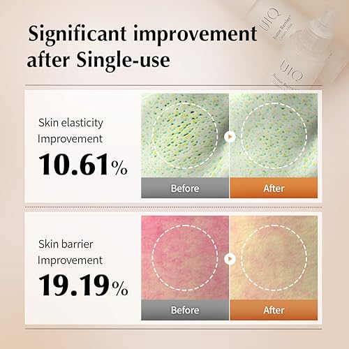 UIQ Biome Barrier Cream Mist, Skin Microbiome-Powered Face Mist with Hyaluronic Acid & Niacinamide, Deep Hydration, Glow & Soothing, Korean Skin Care, 100ml / 3.38 fl. oz