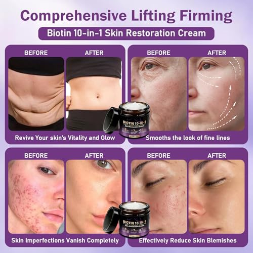 zhjely Biotin 10-in-1 Skin Restoration Cream, Biotin Moisturizing Cream, Effectively Smoothes Skin, for All Skin Type (2PCS)