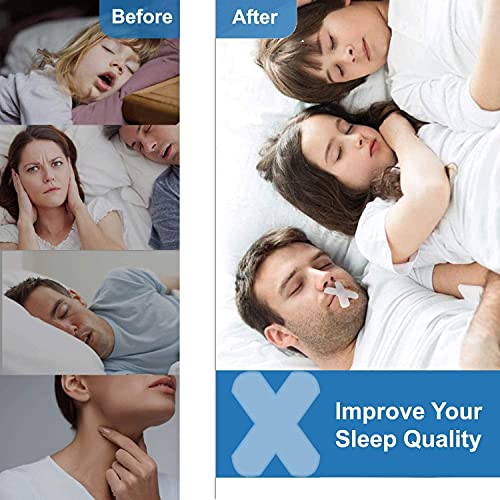 Sleep-Strips-Improve-Sleep-Quality-Better-Nose-Breathing-and-Reduce-Mouth-Breathing-and-Snoring-Adhesive-Mouth-Tape-Anti-Snoring-Tapes-for-Adult-Less-Mouth-Breath-and-Snore-90