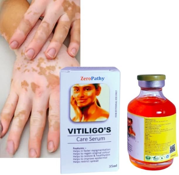 Zero Pathy Vaitiligos Gel White Spot Clear Vaitiligos cream Safed Daag -
