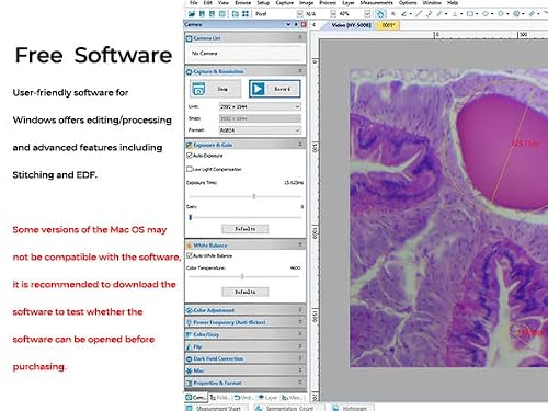 [Full 4K HD 1080P] HDMI USB C-Mount Digital Vabiooth Microscope Camera with Software Calibration Compatible with WIN7/8/10 Mac System, C-Mount 25mm & 30mm 30.5mm Adapter - Thumbnail 2
