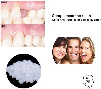 10g Temporary Moldable False Teeth Repair Replacement Thermal Fitting Beads - Instant Confident Smile (Bright White)