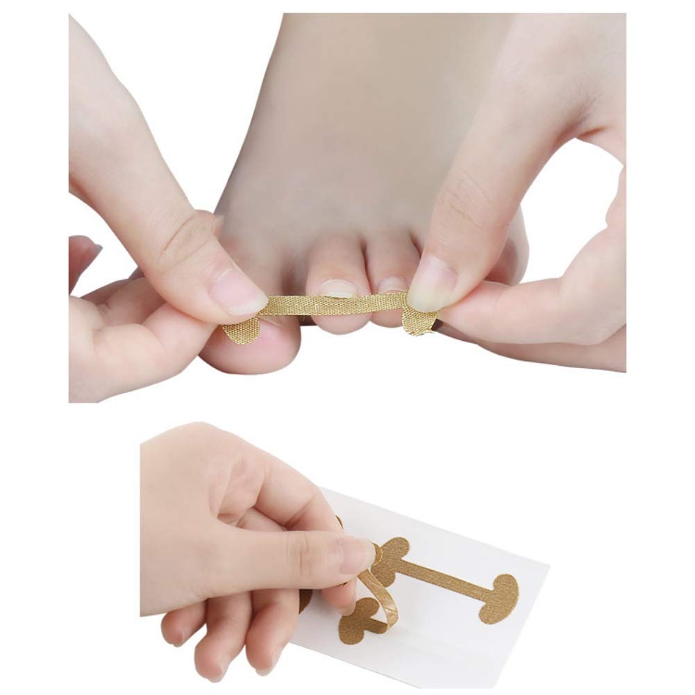 Ingrown Toenail Correction Patches 20Pcs Set Curved Toenails Brace Thick Paronychia Correction Recover Treatment Tool Ingrown Toenail Straightening Clip Pedicure Tool : Beauty & Personal Care