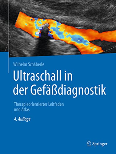 Ultraschall in der Gefäßdiagnostik: Therapieorientierter Leitfaden und Atlas (German Edition)
