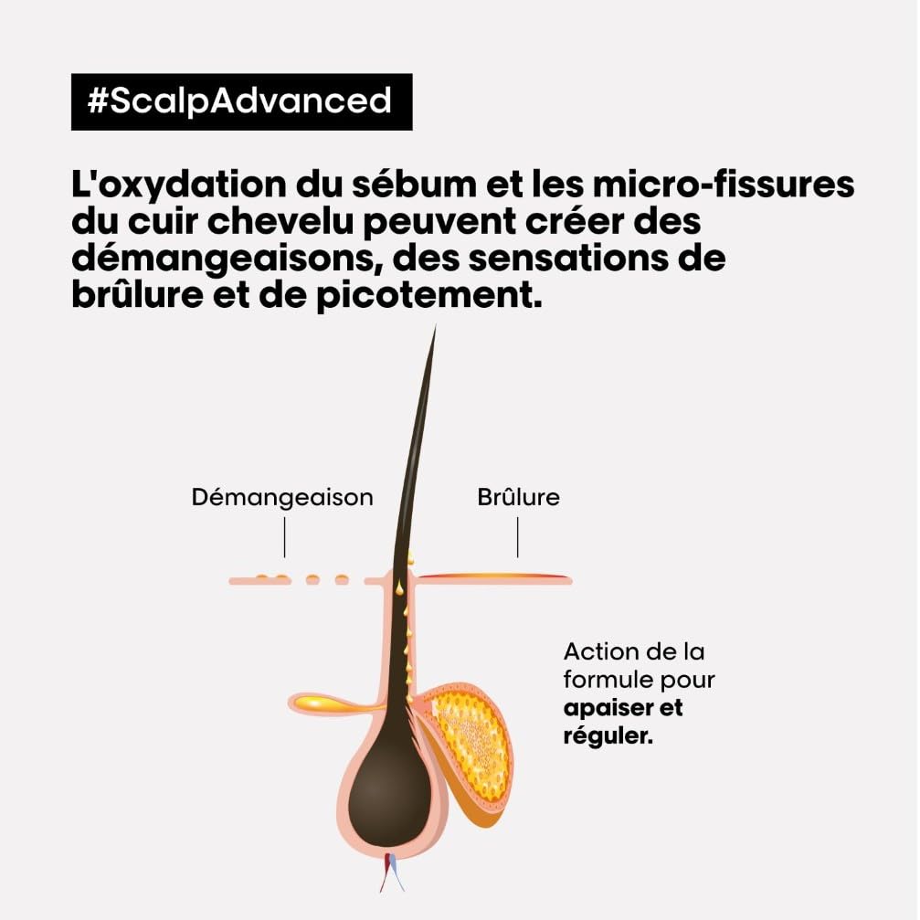 L'OREAL PROFESSIONNEL - Scalp Advanced Anti-Inconfort & Démangeaisons - +83% d'Apaisement du Cuir Chevelu et +49% d'Hydratation - Dermo-Régulateur pour Cuirs Chevelus Sensibles - Sans Silicone