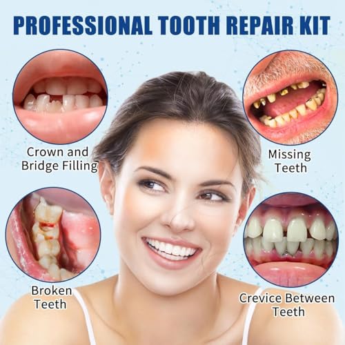 Image of Zinc Oxide Eugenol Cement, Temporary Teeth Replacement Kit for Fixing Filling Missing and Gaps,Temporary Fixed Crown and Bridge.
