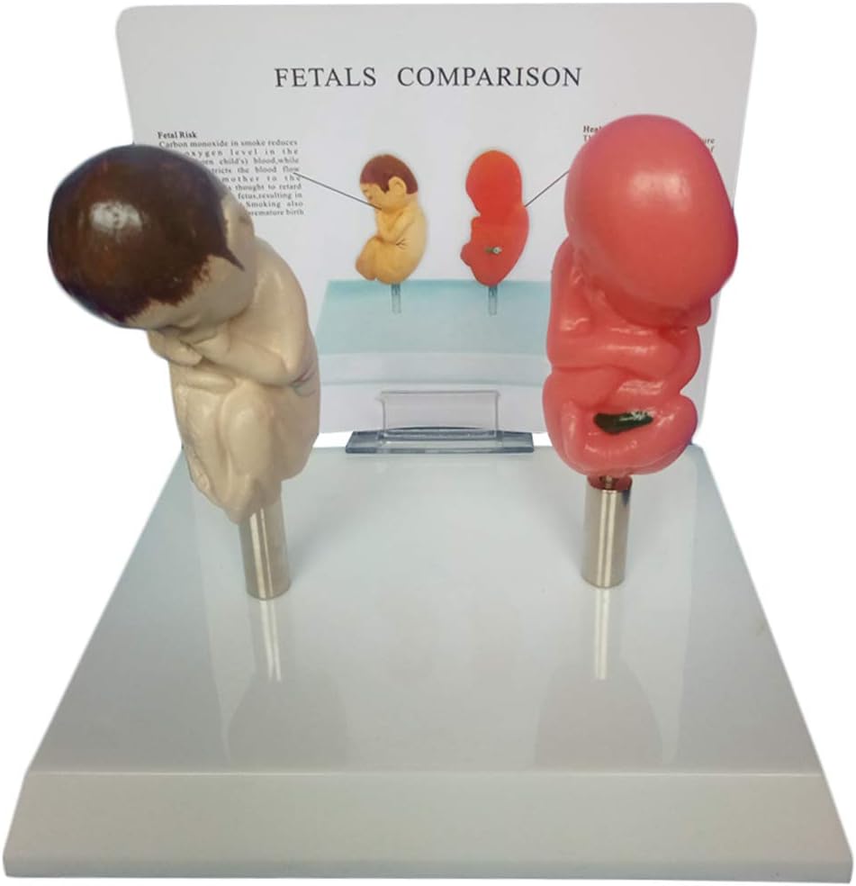 胎児モデルγ喫煙胎児と正常胎児の比較γPVC材料解剖学的科学モデルγ広告教育医学モデルの研究に用いる