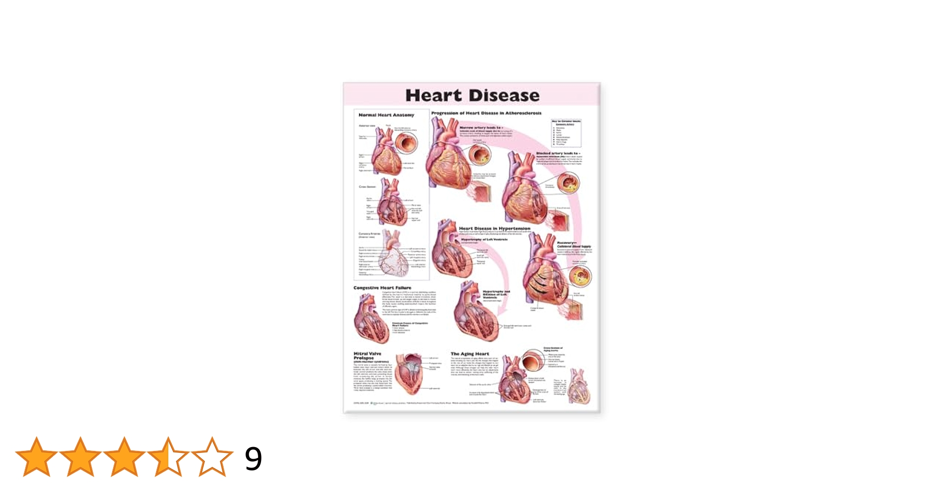 健康・医学 HEART DISEASE Amazon | Heart Disease Anatomical Chart | Anatomical Chart