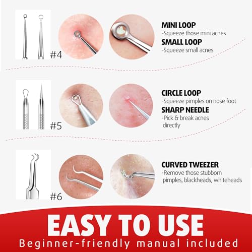Cbiumpro BLACKHEAD REMOVER PIMPLE POPPER KIT Blackhead Remover Tools thumb #3
