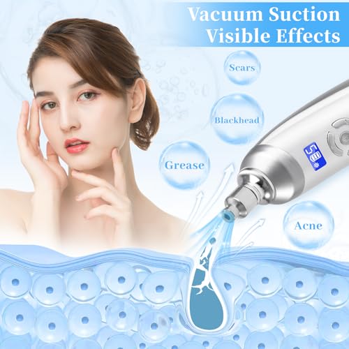 Beauty Star Cordless Microdermabrasion