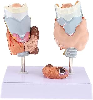 Thyroid Pathology Model， Human Medical Anatomical Model of Hyperthyroidism， Thyroid Structure Model Suppliesuseful SaiFei
