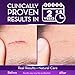 Cicatricure Advanced Scar Gel for Face & Body - Proven Results in 2 Weeks, Scar Treatment for Surgical Scars, Stretch Marks, Scars of Burns and Injuries, Acne Scar Treatment, 1 oz (28 g)