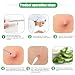 Imagen de 8PCS Herramientas para Eliminar Puntos Negros Extractor Kit