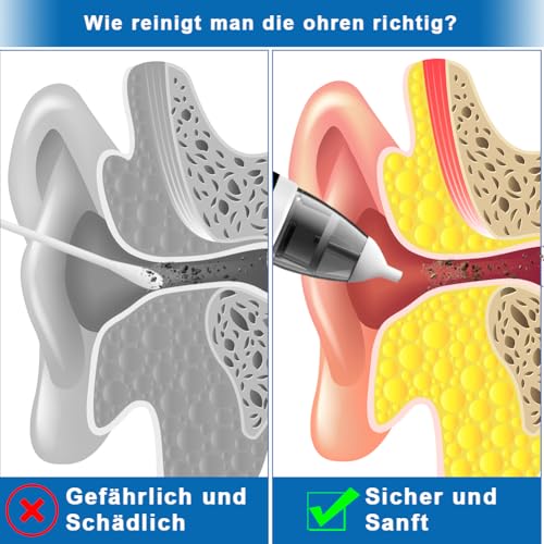 Aohcae Ohrenschmalz Entferner Sauger,360 Grad Ohrensauger Ohrenschmalz Entferner Ear Cleaning Kit für Kinder Haustier und erwachsene