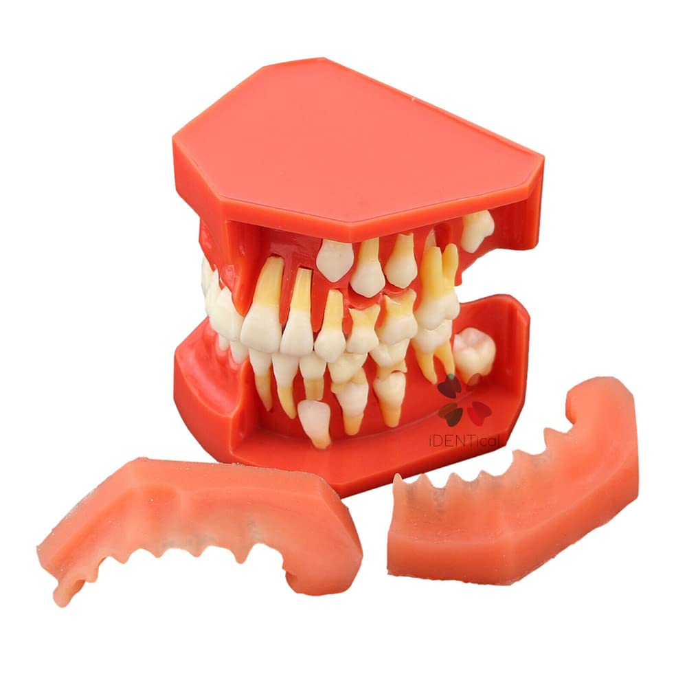 See full amazon price history chart for iDENTical Dentition stage Pediatric Development Model M7013 (Age 9-12 Yrs.) iDENTical Dentition stage Pediatric Development Model M7013 (Age 9-12 Yrs.) (B0BWNHLQ6S) Amazon Price History, Amazon Price Tracker