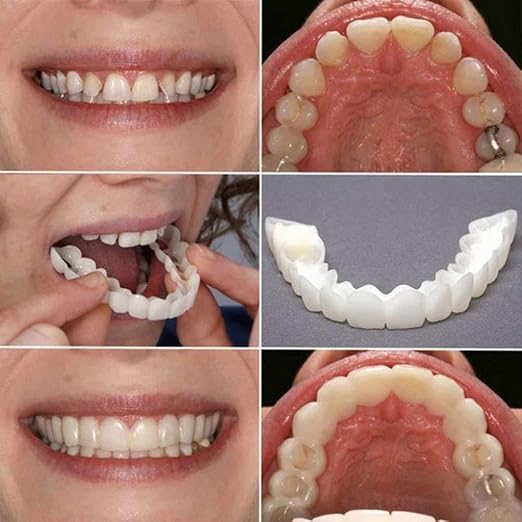 Snap-On Instant Perfect Smile Veneers Comfortable Flex Fit Dentures for Top & Bottom Teeth White Tooth Cosmetic Cover Comfort Fit Flex Dentures for White Neat Smile (pack of 1) 2