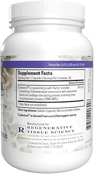Ostinol Standard 350mg - Bone & Joint Supplement for Moderate Bone Loss & Moderate Joint Support - 30 Capsules