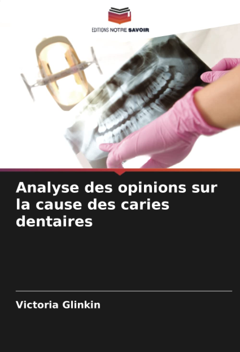 Analyse des opinions sur la cause des caries dentaires