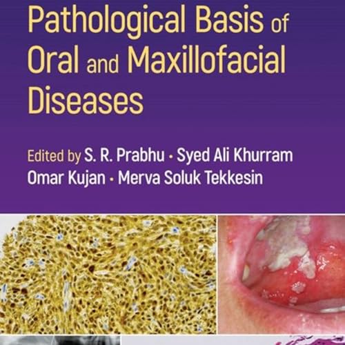 Pathological Basis of Oral and Maxillofacial Diseases